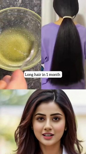 Hair falling stop just few days #hair #hairstyles #hairtreatment #hairfallcontrol #hairfallsolution #trend #foryou | Dr Health Tips