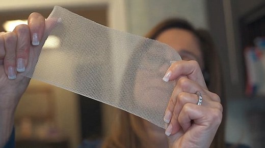 Breast implant GalaFlex 'provides long lasting support'