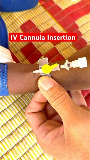 IV Cannula Insertion Procedure.#youtubeshorts #shortvideo #ivcannulation #cannula #nursingskills