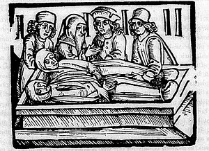 Sweating Sickness of Tudor England - Historic Mysteries