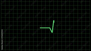 ECG cardiograph looping animation. Heartbeat flatline green line animation 4K resolution