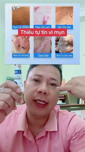 Mụn cóc mụn thịt làm bạn thiếu tự tin #tuvituongsohanoi #muncoc