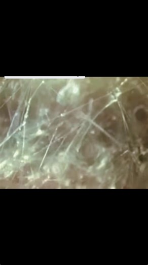 Well… that’s just fascianating 😄 What you’re seeing here is live arthroscopic footage of fascia inside a living human body. No CGI. No pseudoscience. No speculation or guesswork. This is fascia as it truly exists — alive, responsive, and dynamic. Fascia is not just in the body. The body is inside the fascia. It maintains our structural integrity, distributes force, and responds to repeated stress patterns. It is plastic, meaning it is constantly molding, shifting, and adapting to the environmen