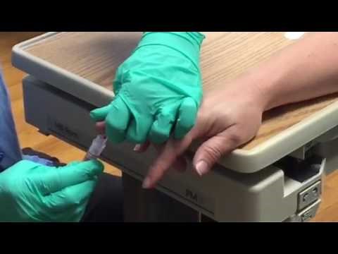 FIngerstick with microtainer colection