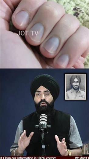 What Your Nails Reveal About Your Health! Warning Signs #HealthTips #NailHealth #WarningSigns
