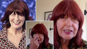Loose Women's Janet Street-Porter reveals she has skin cancer and is having surgery this week