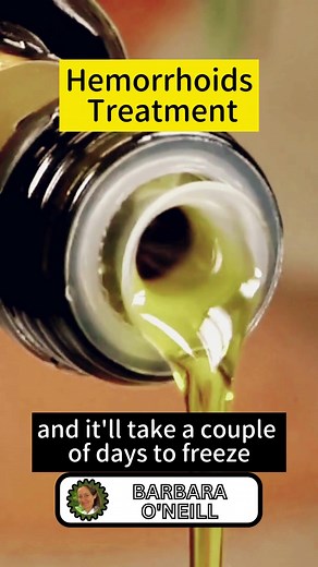 Treatments for Hemorrhoid #Hemorrhoids #treatment #Naturalremedies #diet #lifestyles #sugar #dairy #castoroil #barbaraoneill #drbarbaraoneill #fyp