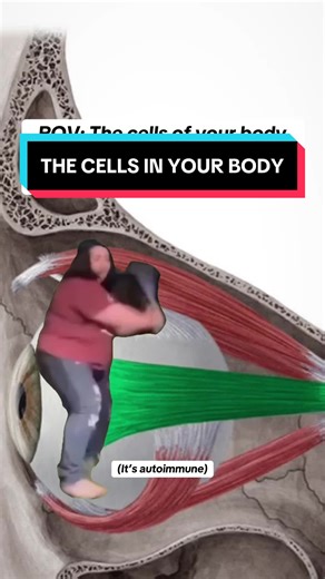 👁️ Why Autoimmune Eye Damage Can Be Permanent When your immune system targets your Extraocular Muscles (EOM), it isn't just a temporary flare. Consistent inflammation leads to fibrosis: turning flexible muscle into stiff scar tissue. 🧬 The Main Culprits: • Thyroid Eye Disease (TED): The #1 cause. Muscles swell and then scar,