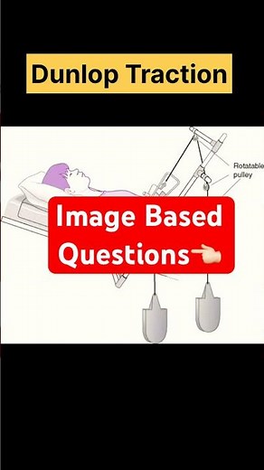 Types of Traction #tractions #skeletaltraction #imagebasedquestion #norcet10 #norcet #norcet2026