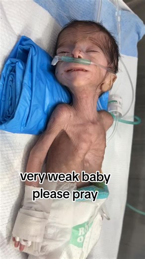 Support for Very Weak Newborns: A Call for Prayers