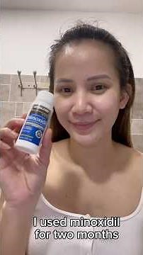 Minoxidil Kirkland review#beforeandafter #hairgrowth #hairloss #haircare #hairtransformation #shopee