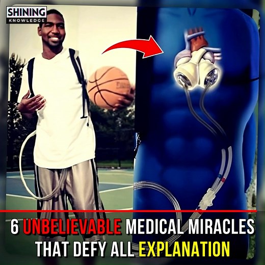 8.2K views · 139 reactions | 6 Unbelievable Medical Miracles That Defy All Explanation | Shining Knowledge | Facebook