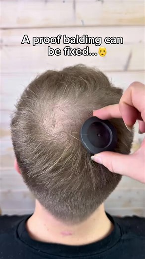 Effective Solutions for Hair Loss and Growth