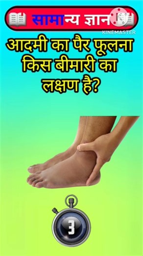 Top 50 ✍️ IAS Question🔥💯🥰 || GK Question and Answer|Part-181| #facts #gkfacts #gkinhindi #staticgk