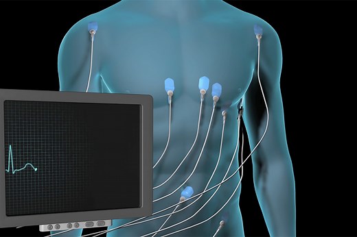 Electrocardiogram, EKG, Offered at Mercy in Baltimore, Maryland