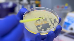 Intravitreal Injection and Quantitation of Infection Parameters in a Mouse Model of Bacterial Endophthalmitis