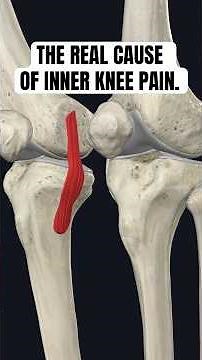 Inner Knee Pain? Stop Stretching It Until You Watch This #kneepain #kneepainrelief