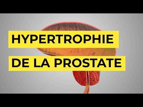 Traitement de l'hypertrophie de la prostate