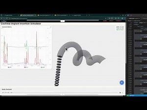 Inside a Cochlear Implant: A Virtual Reality Simulation