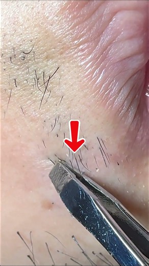 Pluck & Pop: Ultra Close ASMR