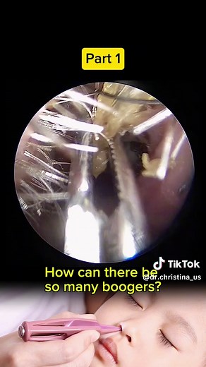 Effective Booger Removal for Stuffy Nose Relief