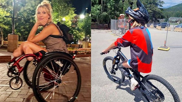 Double amputee and model fights to stay mobile as duct-taped prosthetics fall apart