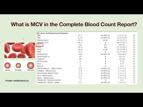 What is MCV? Why my MCV value is abnormal?