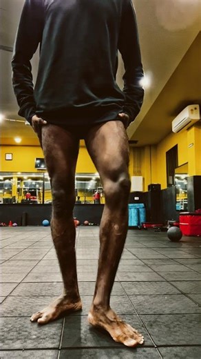 My leg injury after imbalance #fitness #motivation