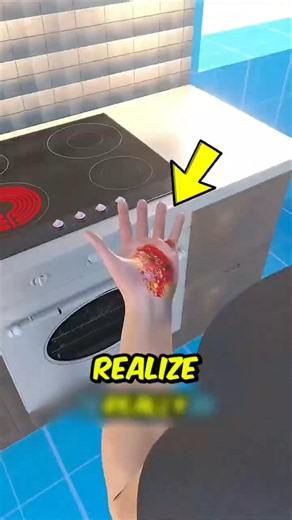 You’re Treating Burns WRONG! The First 5 Minutes Could Save Your Skin 🔥