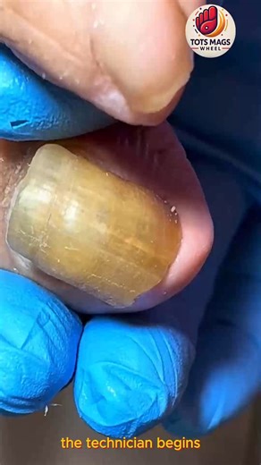 3.1K views · 27 reactions | Proven Steps to Help Seniors Reduce Daily Foot Pain #FootWellnessUSA #SafeNailCare #FootCareTips | Tots Mags Wheel | Facebook