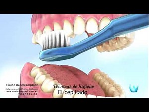 Tips para pacientes, Técnicas de Cepillado