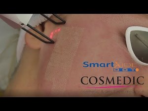 Cosmedic SmartXide Dot