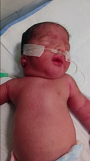 🧠 What Is HIE (Hypoxic-Ischemic Encephalopathy)?