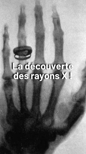 La folle découverte des rayons X ! 🩻☢️ 🎥 Vidéo crée par @arthur.gublin Abonne-toi pour découvrir le monde avec des ordres de grandeur ! 👉 @ordresdegrandeur Les sources de la vidéo sont disponibles sur notre site 👨‍💻 (lien en bio) #physique #nobel #science #histoire #nucléaire | Ordres de Grandeur