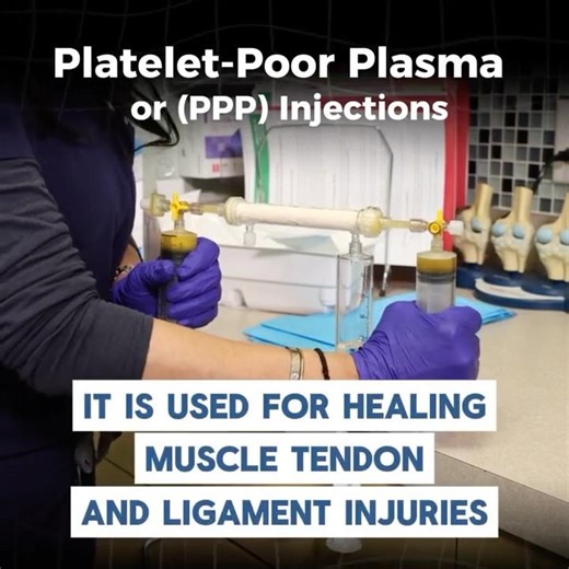 PPP Injections for Muscle Injuries Do They Work