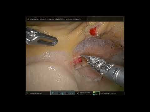 Surgical Training with Organ Modeles : The IMA Model