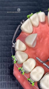 Dr. Diler Cruz #CEDC #dentist #dentistry #dentistryworld #medicine #reelsvideo #reelkarofeelkaro #reels2023 #reelitfeelit #reelschallenge #reelsfacebook #reelsviralシ #reelsusa #fypシ゚ #fypシ゚viralシ | Dr. Diler Cruz