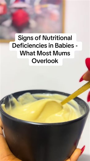 SIGNS OF NUTRITIONAL DEFICIENCIES IN BABIES —WHAT MOST MUMS OVERLOOK Many babies are eating… but are they truly being nourished? Here are quiet signs many mothers don’t realize are linked to poor nutrition: • Poor weight gain • Weak immunity / frequent sickness • Delayed milestones • Constant fatigue or low energy • Pale skin • Poor appetite • Frequent diarrhea or constipation These signs don’t always mean your child is “just small” or “a late bloomer.” Often, the body is simply not getting the