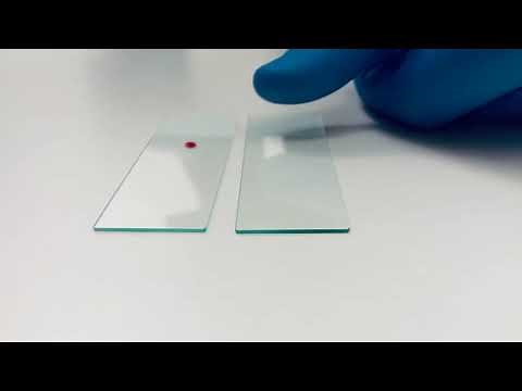 How to make a blood smear
