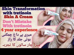 How To Apply Tretinoin SkinA Retinoid Cream| My Skin Transformation With Tretinoin SkinA Retinoid