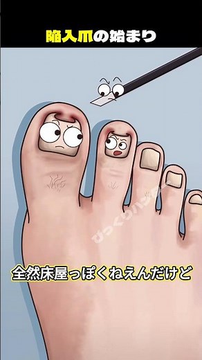陥入爪の始まり?!