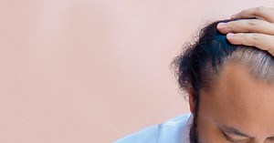 Potential Causes of Hair Loss