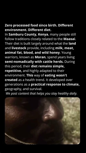 Zero processed food since birth. Different environment. Different diet.
