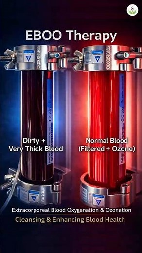 Black Blood Turned Clean in Minutes 😱 | EBOO + Ozone Therapy | Care Well Medical Centre