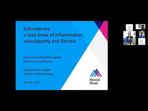 Scleroderma: a toxic brew of inflammation, vasculopathy and fibrosis