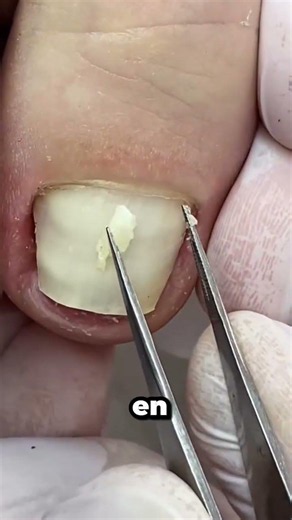 Would you like to learn aesthetic pedicures, foot spas, and onychocryptosis techniques? 👣