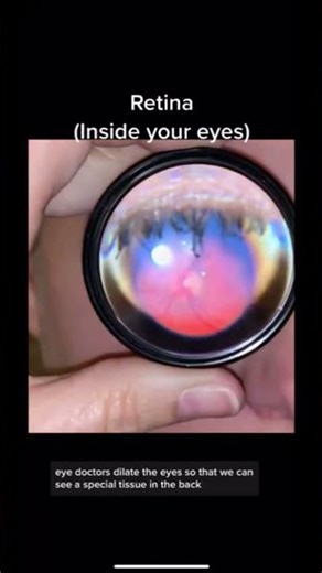 #optometrylife#optometryacademy#dilated view# fundus examination #optometrytips