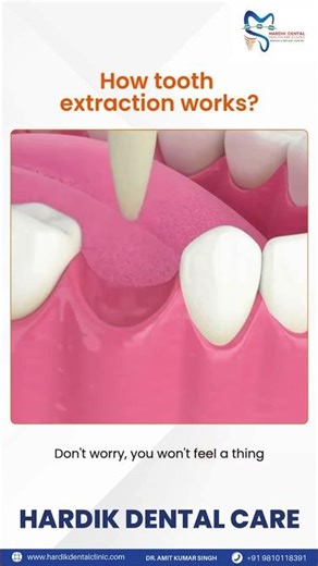 Expert tooth extraction. Comfortable care. Trusted smiles.