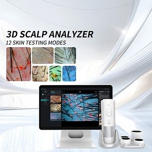 [Hot Item] Intelligent Al 16 Million Pixels Hair Scalp Analysis Scanner Detector Microscope Hair Follicles Analyzer