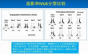 IVUS基本原理和临床应用PPT